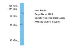 ITIH2 Rabbit anti-Human, Polyclonal, Novus Biologicals 0.1ml; Unconjugated:Antibodies,